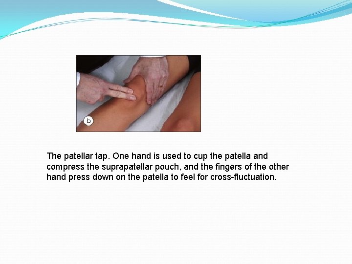 The patellar tap. One hand is used to cup the patella and compress the
