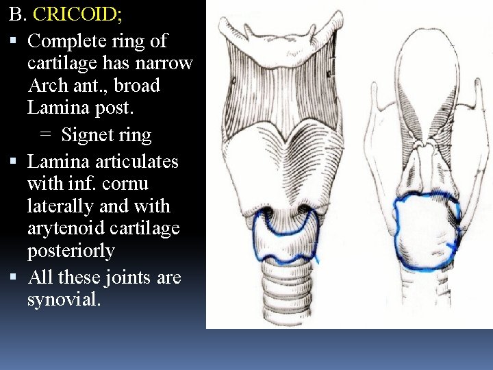 B. CRICOID; Complete ring of cartilage has narrow Arch ant. , broad Lamina post.