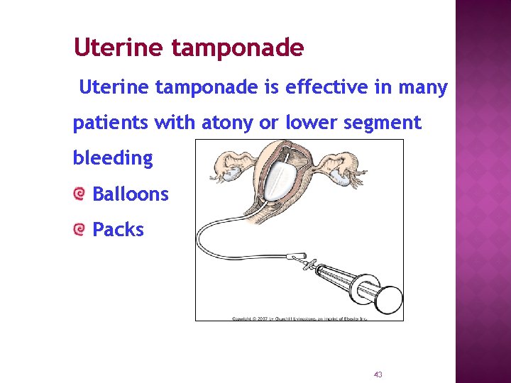 Uterine tamponade is effective in many patients with atony or lower segment bleeding Balloons