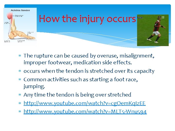 How the injury occurs The rupture can be caused by overuse, misalignment, improper footwear,