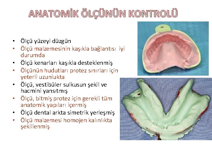 ANATOMİK ÖLÇÜNÜN KONTROLÜ • Ölçü yüzeyi düzgün • Ölçü malzemesinin kaşıkla bağlantısı iyi durumda