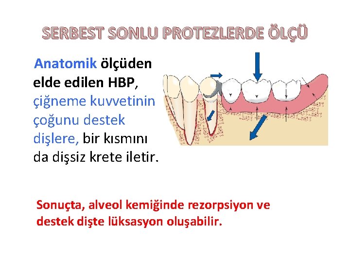 SERBEST SONLU PROTEZLERDE ÖLÇÜ Anatomik ölçüden elde edilen HBP, çiğneme kuvvetinin çoğunu destek dişlere,