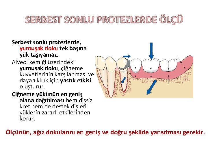 SERBEST SONLU PROTEZLERDE ÖLÇÜ Serbest sonlu protezlerde, yumuşak doku tek başına yük taşıyamaz. Alveol