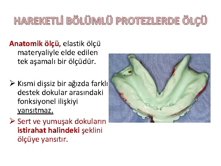 HAREKETLİ BÖLÜMLÜ PROTEZLERDE ÖLÇÜ Anatomik ölçü, elastik ölçü materyaliyle elde edilen tek aşamalı bir