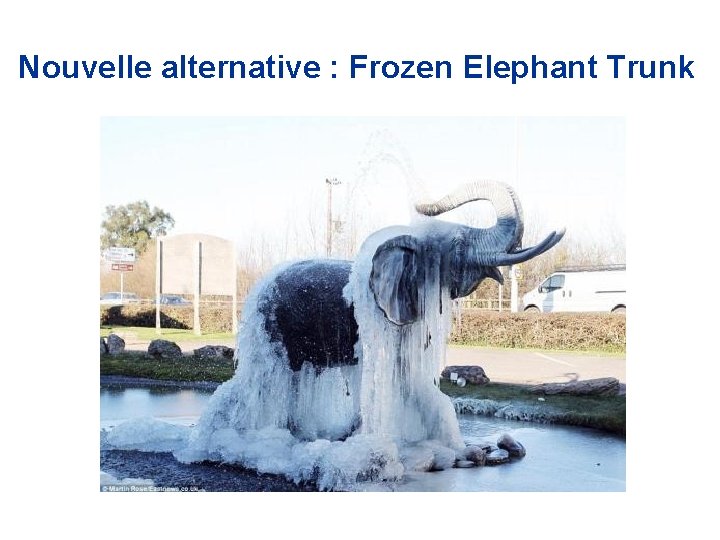 Nouvelle alternative : Frozen Elephant Trunk 