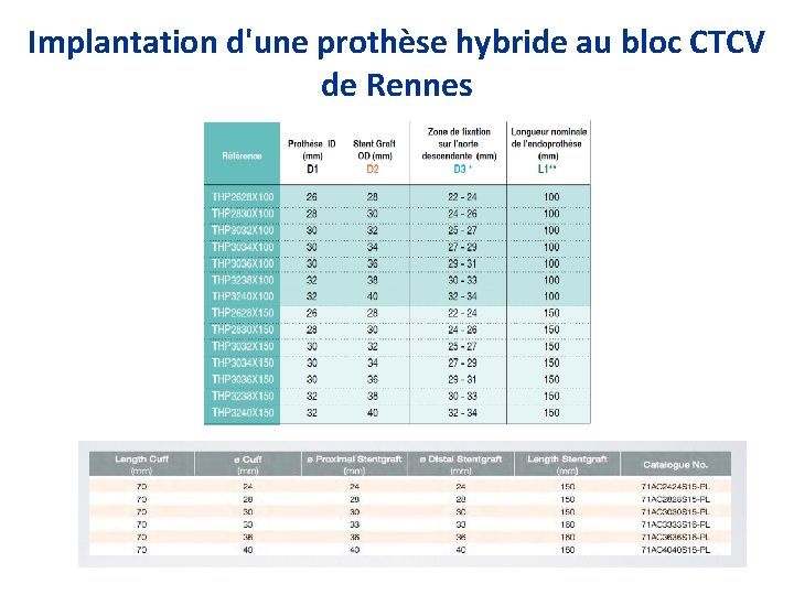 Implantation d'une prothèse hybride au bloc CTCV de Rennes 