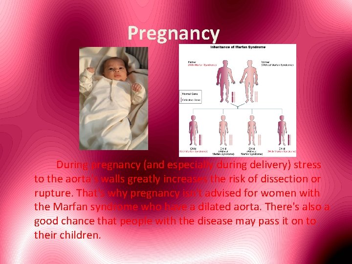 Pregnancy During pregnancy (and especially during delivery) stress to the aorta's walls greatly increases