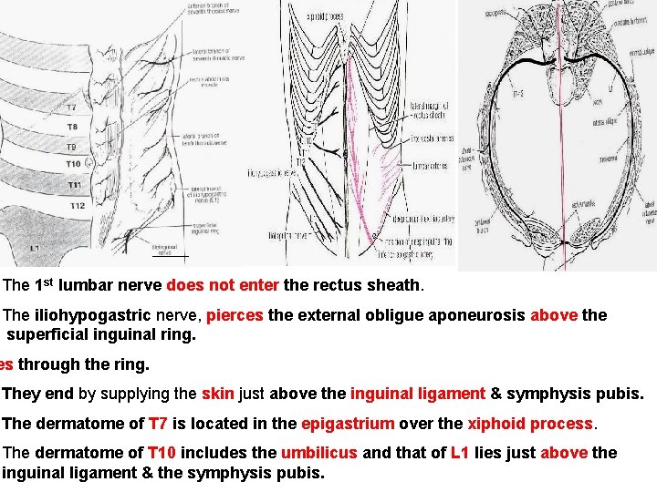 The 1 st lumbar nerve does not enter the rectus sheath. The iliohypogastric nerve,