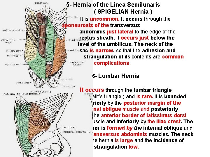 5 - Hernia of the Linea Semilunaris ( SPIGELIAN Hernia ) It is uncommon.