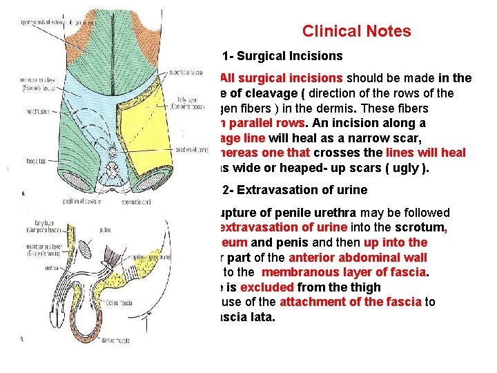 Clinical Notes 1 - Surgical Incisions All surgical incisions should be made in the