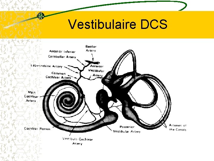 Vestibulaire DCS 