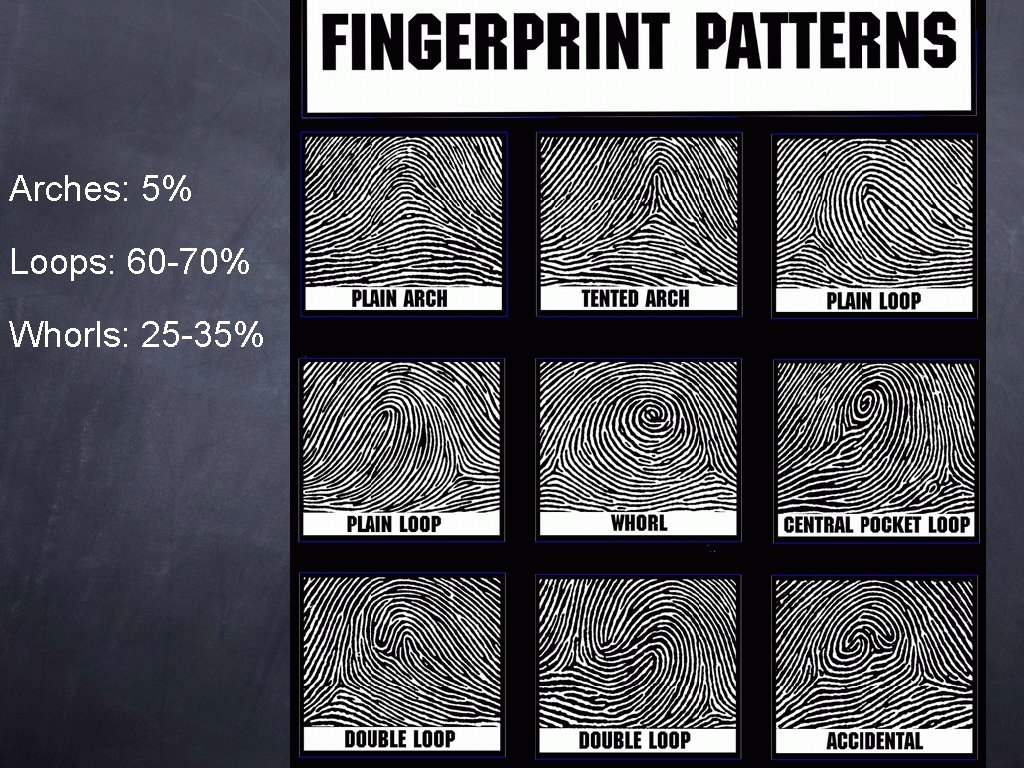 Arches: 5% Loops: 60 -70% Whorls: 25 -35% 