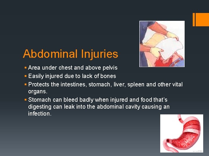 Abdominal Injuries § Area under chest and above pelvis § Easily injured due to