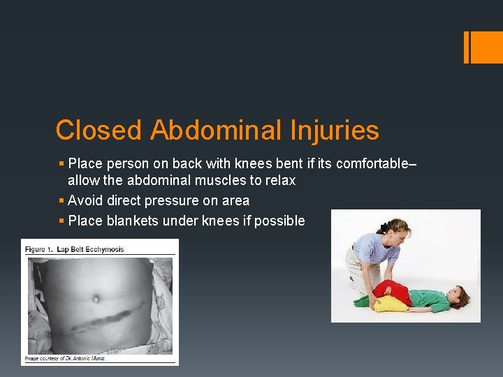 Closed Abdominal Injuries § Place person on back with knees bent if its comfortable–
