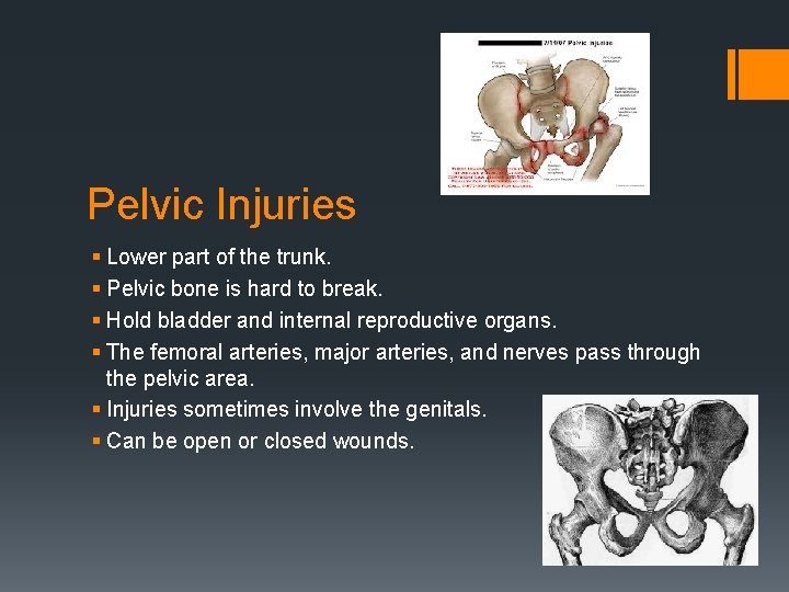 Pelvic Injuries § Lower part of the trunk. § Pelvic bone is hard to