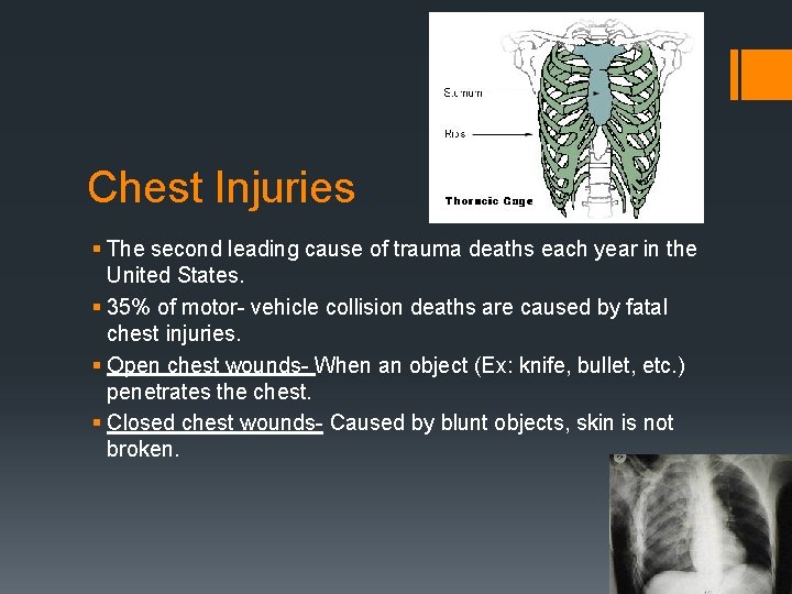 Chest Injuries § The second leading cause of trauma deaths each year in the