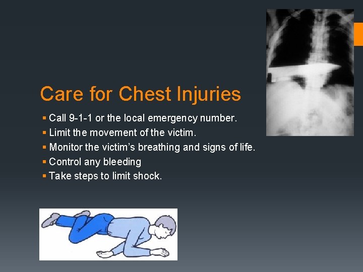 Care for Chest Injuries § Call 9 -1 -1 or the local emergency number.