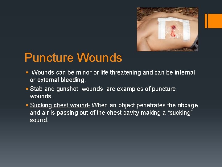 Puncture Wounds § Wounds can be minor or life threatening and can be internal