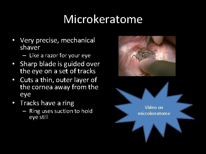Microkeratome • Very precise, mechanical shaver – Like a razor for your eye •
