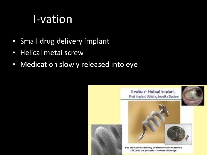 I-vation • Small drug delivery implant • Helical metal screw • Medication slowly released