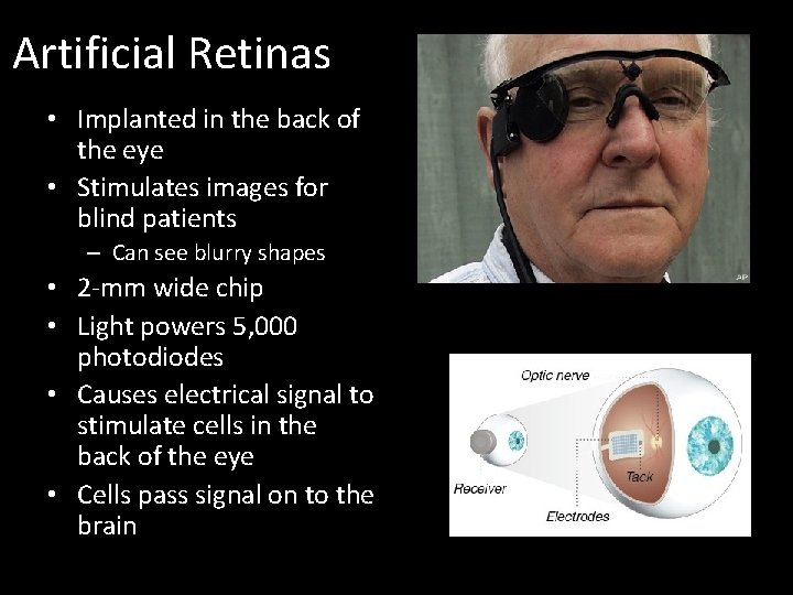 Artificial Retinas • Implanted in the back of the eye • Stimulates images for