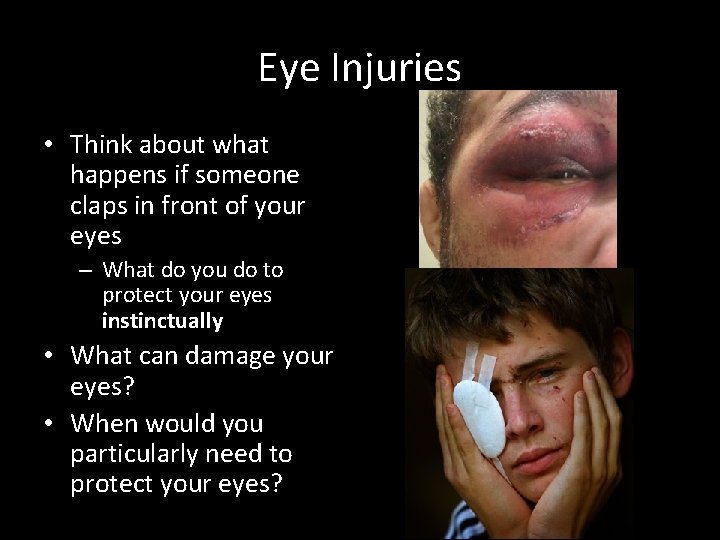 Eye Injuries • Think about what happens if someone claps in front of your