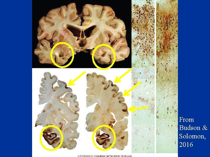 From Budson & Solomon, 2016 