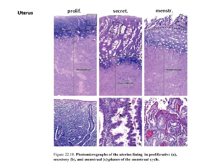 Uterus prolif. secret. menstr. 