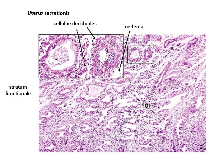 Uterus secretionis cellulae deciduales stratum functionale oedema 