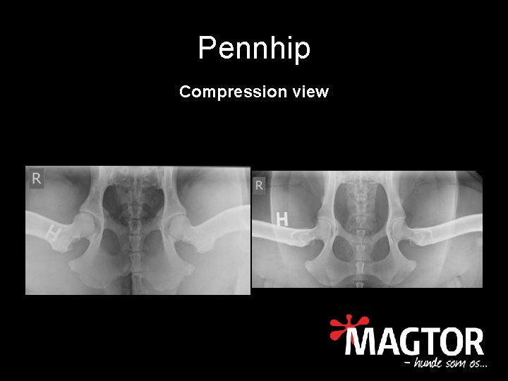 Pennhip Compression view 