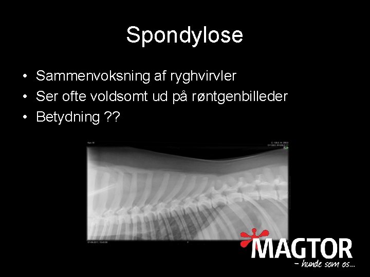 Spondylose • Sammenvoksning af ryghvirvler • Ser ofte voldsomt ud på røntgenbilleder • Betydning