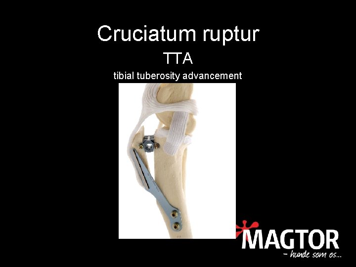 Cruciatum ruptur TTA tibial tuberosity advancement 