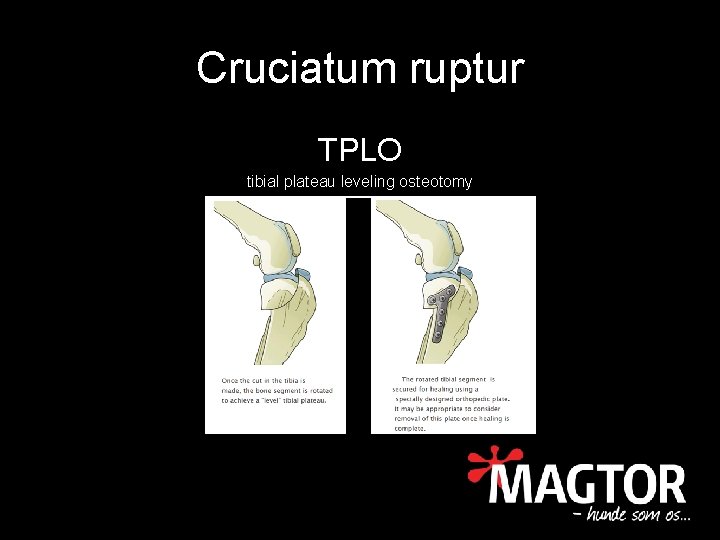 Cruciatum ruptur TPLO tibial plateau leveling osteotomy 