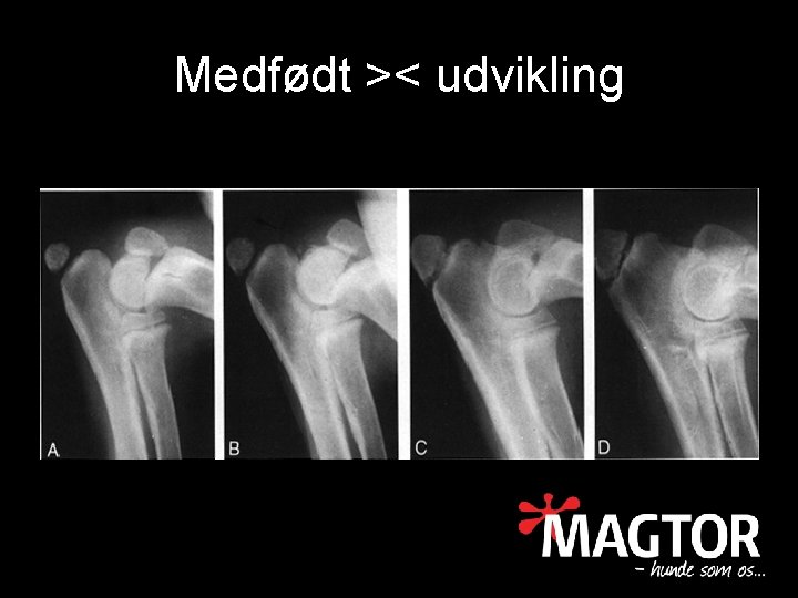Medfødt >< udvikling 