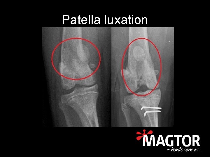 Patella luxation 