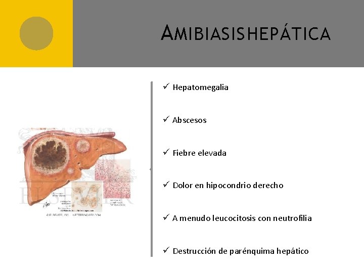 A MIBIASIS HEPÁTICA ü Hepatomegalia ü Abscesos ü Fiebre elevada ü Dolor en hipocondrio