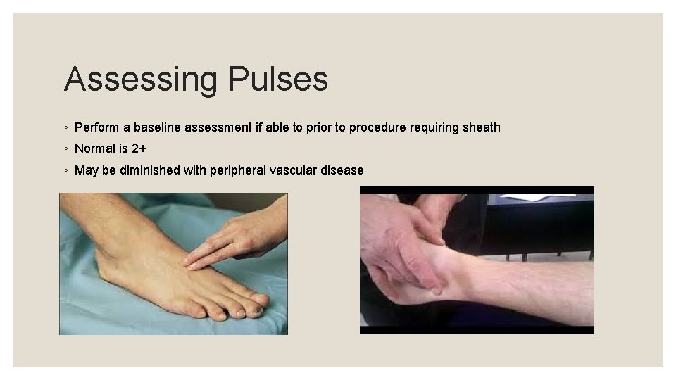 Assessing Pulses ◦ Perform a baseline assessment if able to prior to procedure requiring