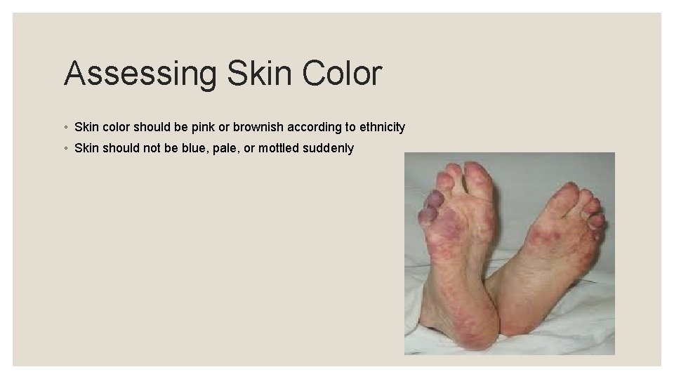 Assessing Skin Color ◦ Skin color should be pink or brownish according to ethnicity