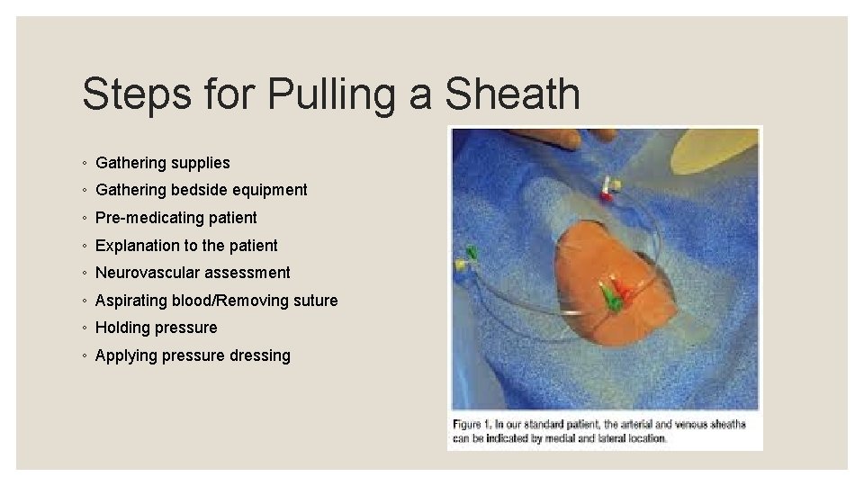 Steps for Pulling a Sheath ◦ Gathering supplies ◦ Gathering bedside equipment ◦ Pre-medicating