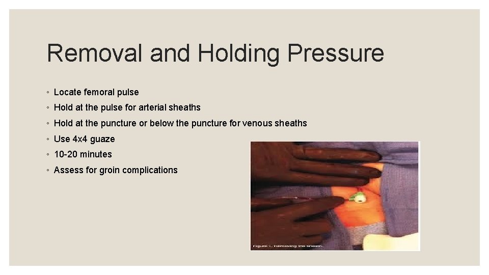 Removal and Holding Pressure ◦ Locate femoral pulse ◦ Hold at the pulse for