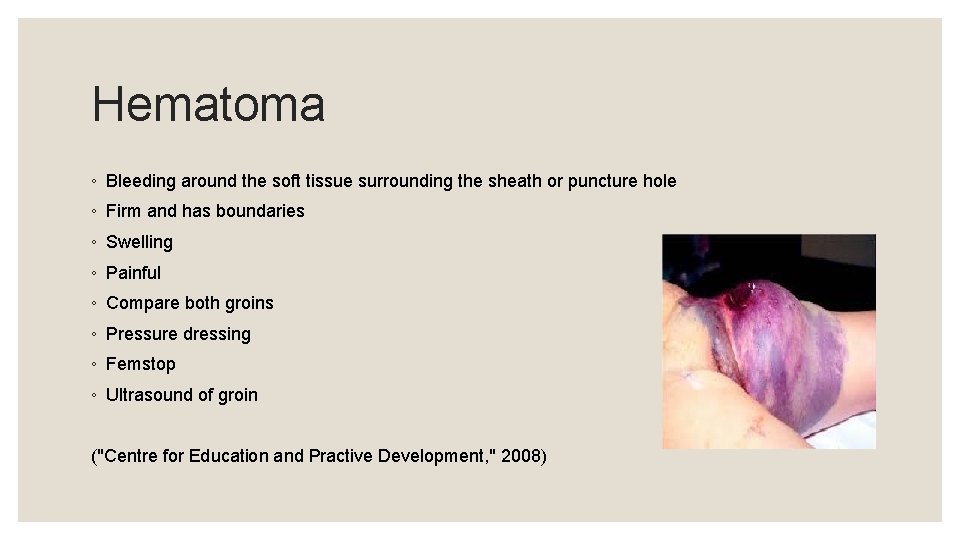 Hematoma ◦ Bleeding around the soft tissue surrounding the sheath or puncture hole ◦