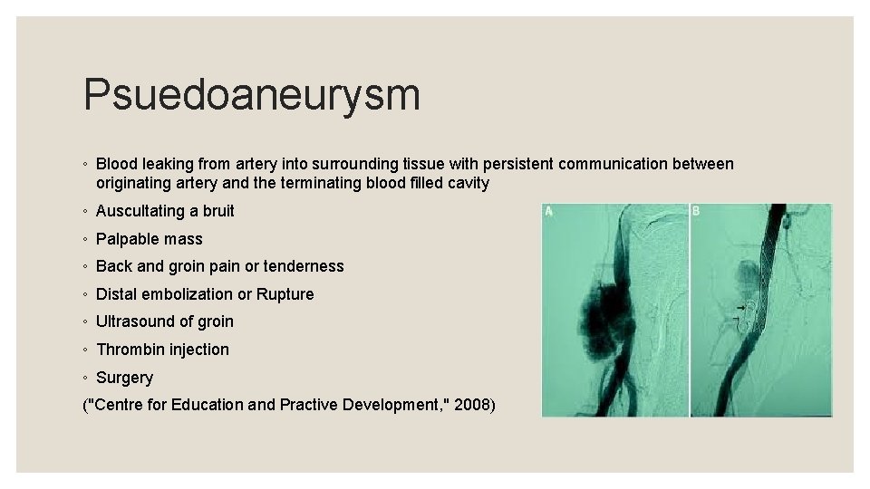 Psuedoaneurysm ◦ Blood leaking from artery into surrounding tissue with persistent communication between originating