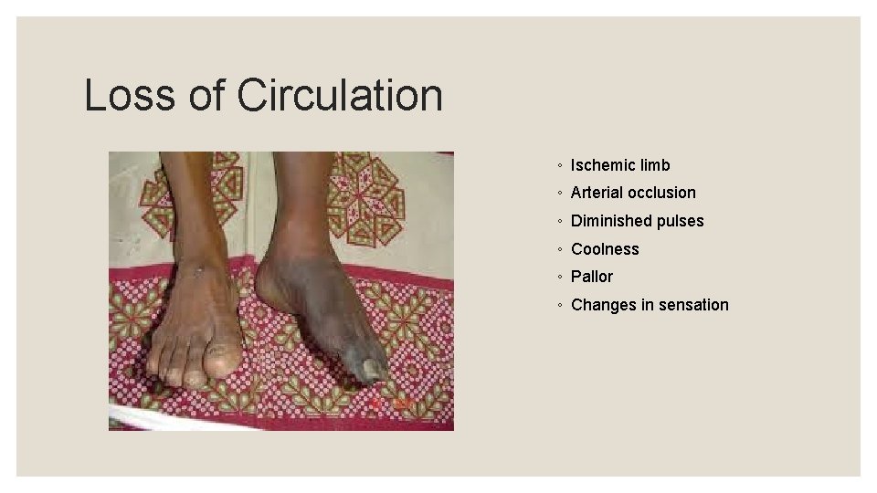 Loss of Circulation ◦ Ischemic limb ◦ Arterial occlusion ◦ Diminished pulses ◦ Coolness