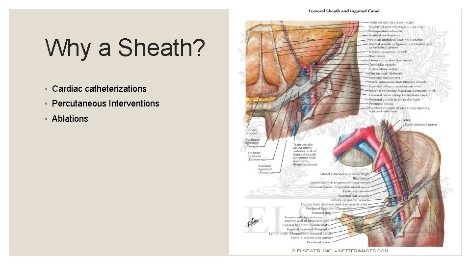 Why a Sheath? ◦ Cardiac catheterizations ◦ Percutaneous Interventions ◦ Ablations 