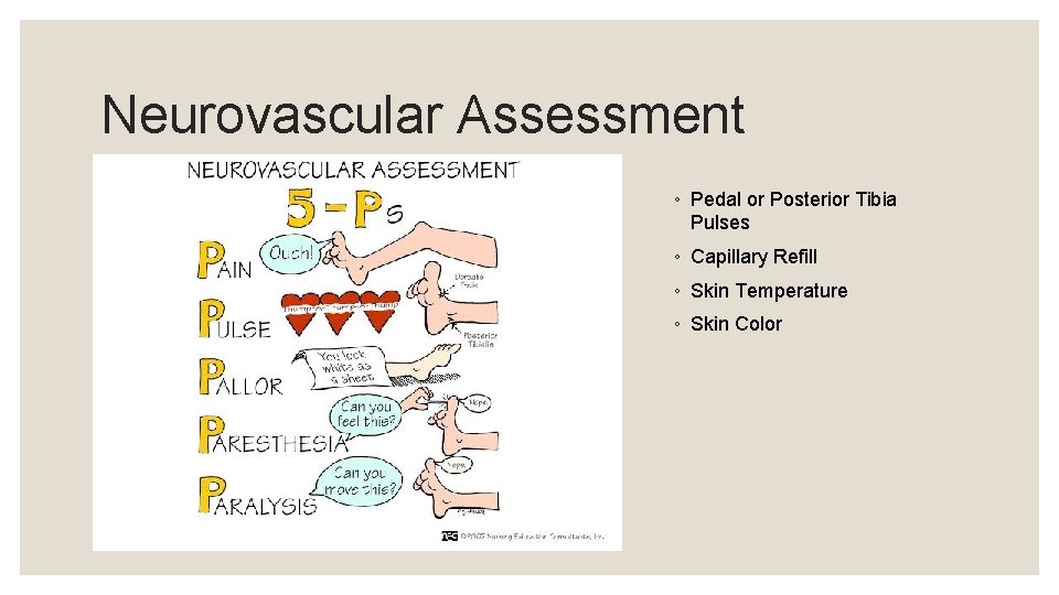 Neurovascular Assessment ◦ Pedal or Posterior Tibia Pulses ◦ Capillary Refill ◦ Skin Temperature