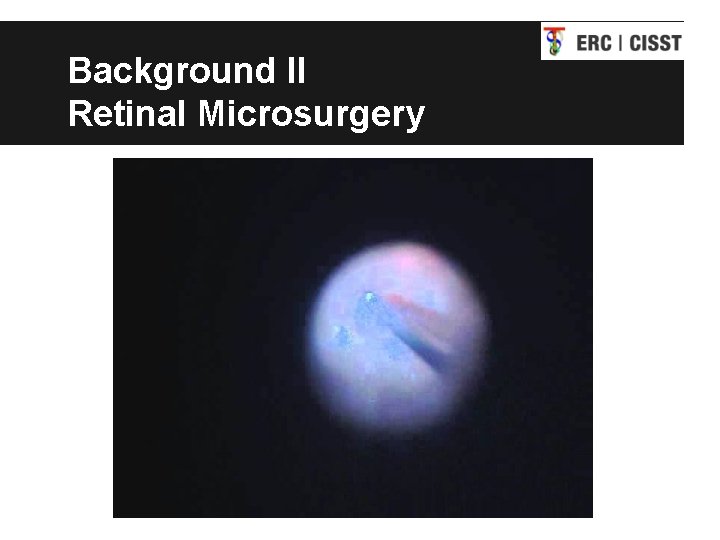 Background II Retinal Microsurgery 