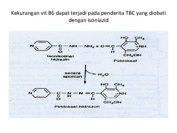 Kekurangan vit B 6 dapat terjadi pada penderita TBC yang diobati dengan isoniazid 