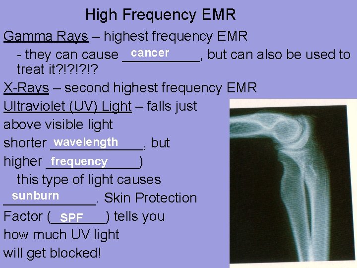 High Frequency EMR Gamma Rays – highest frequency EMR cancer - they can cause