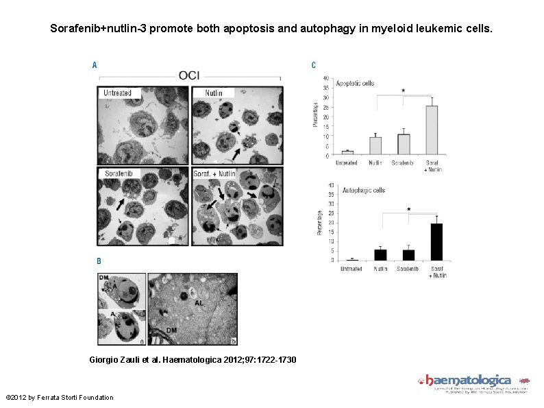 Sorafenib+nutlin-3 promote both apoptosis and autophagy in myeloid leukemic cells. Giorgio Zauli et al.