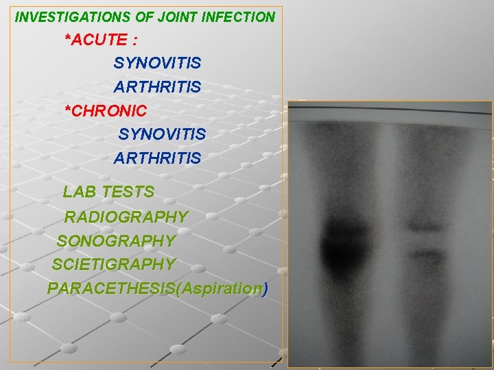 INVESTIGATIONS OF JOINT INFECTION *ACUTE : SYNOVITIS ARTHRITIS *CHRONIC SYNOVITIS ARTHRITIS LAB TESTS RADIOGRAPHY